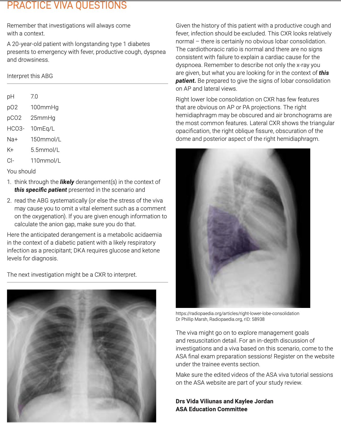 ANAESTHESIA TRAINING TIPS | Doctor Vida